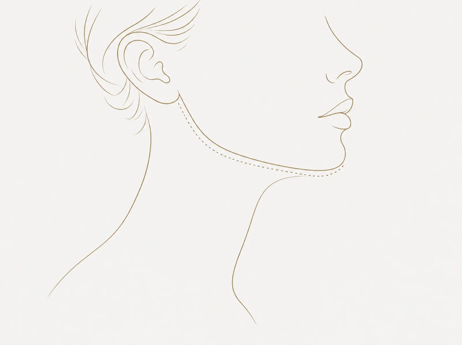 ภาพลายเส้นใบหน้าส่วนล่างและลำคอด้านข้าง มีเส้นประลากตามแนวกรามและใต้คาง
