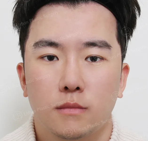 Eyes, After, Front