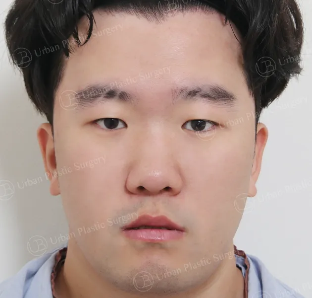 Eyes, Before, Front