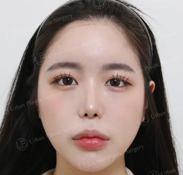 Eyes, After, Front