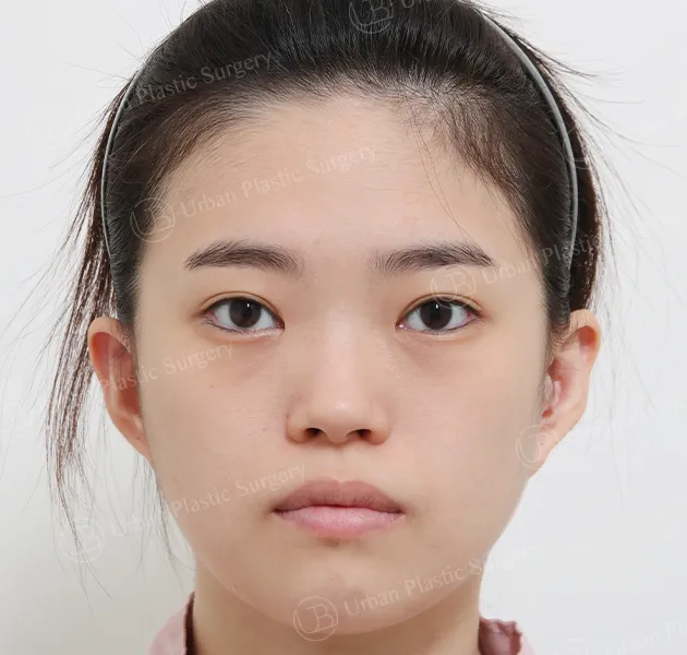 Eyes, Before, Front