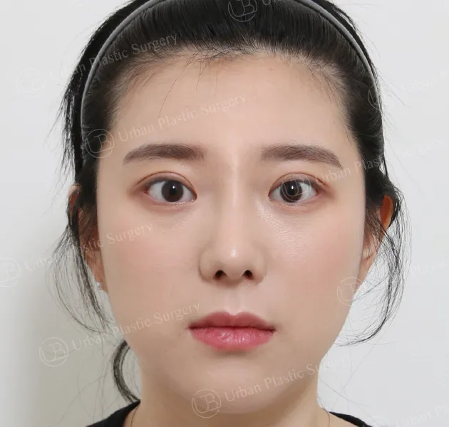 Eyes, After, Front