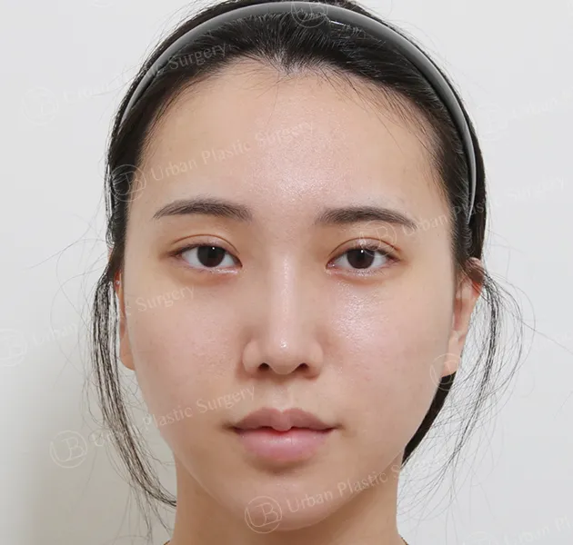 Eyes, After, Front