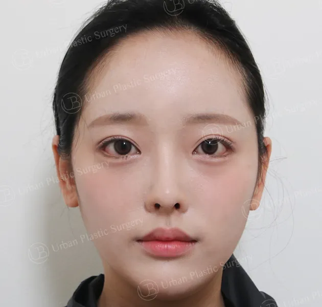 Eyes, After, Front