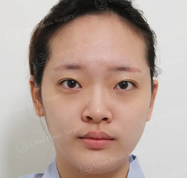 Eyes, Before, Front