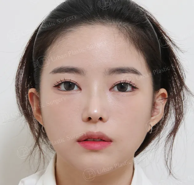 Eyes, After, Front