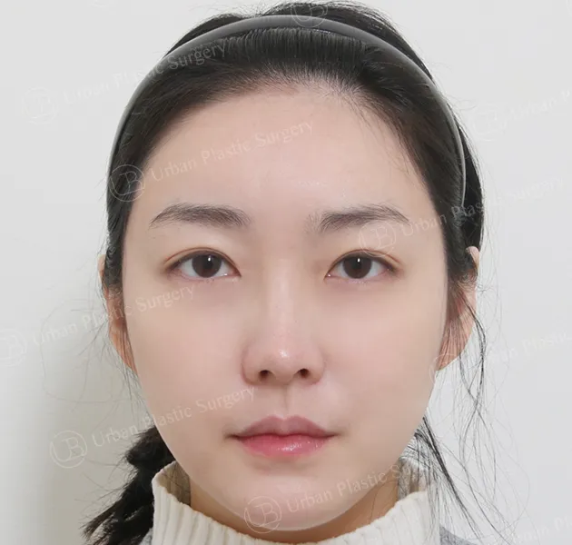 Eyes, After, Front
