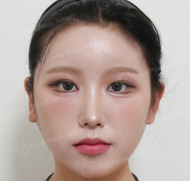 Eyes, After, Front