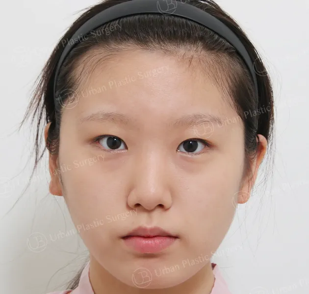 Eyes, Before, Front