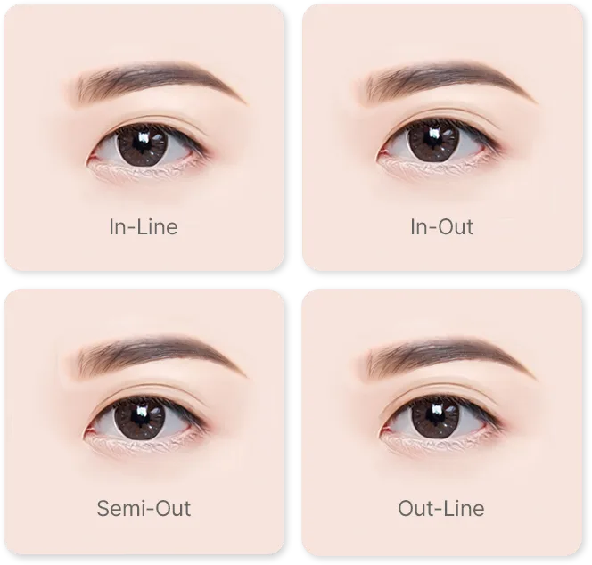 Empat panel yang memperlihatkan mata terbuka yang sama dengan lipatan kelopak atas yang berbeda, berlabel In-Line, In-Out, Semi-Out, dan Out-Line.