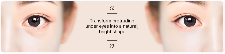 Gambar dari klinik tentang lemak bawah mata yang menonjol ke depan, dengan tulisan: "Transform protruding under eyes into a natural, bright shape."