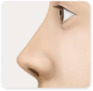 ภาพวาดด้านข้างของคลินิก แสดงจมูกที่สั้นและเชิดก่อนผ่าตัด