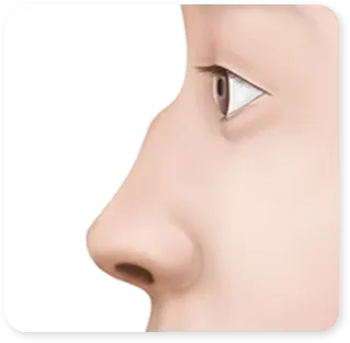 ภาพของคลินิกจากส่วนที่มีหัวข้อว่า “What is a humped nose?”