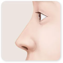 ภาพวาดขั้นที่ 05 ของคลินิกสำหรับการแก้จมูกยาว: เส้นด้านข้างหลังค้ำและยกปลายจมูกแล้ว
