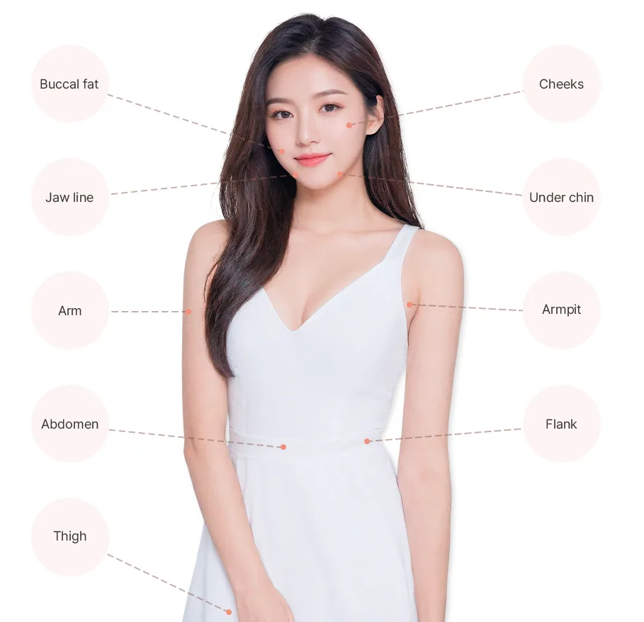 Hình của phòng khám cho mục “Các vùng tiêm tan mỡ” (Areas for fat dissolving injection).