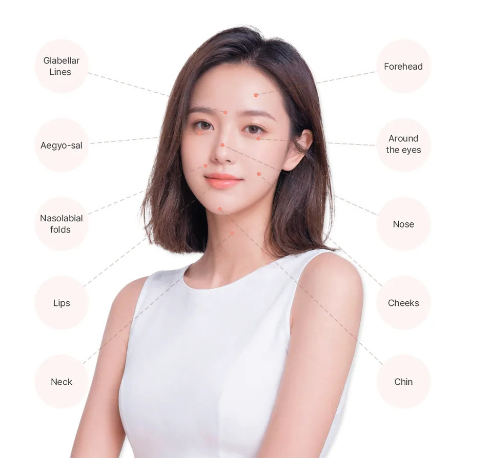ภาพของคลินิกสำหรับหัวข้อ “Areas for Filler Injections”